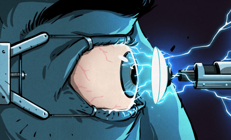 Reshaping Eyeballs With Electricity, No Lasers Or Cutting Required