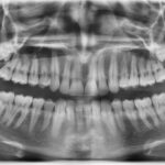 The Singing Dentures Of Manchester And Other Places