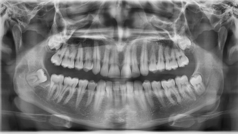 The Singing Dentures Of Manchester And Other Places